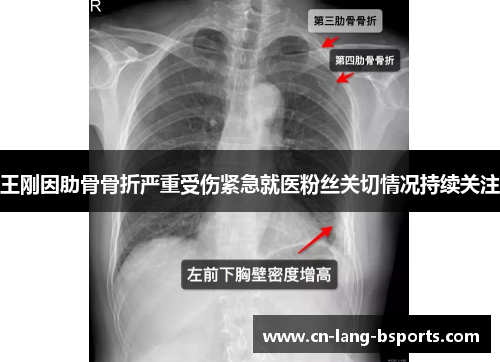 王刚因肋骨骨折严重受伤紧急就医粉丝关切情况持续关注 王刚因肋骨骨折严重受伤紧急就医粉丝关切情况持续关注